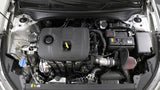 2019-2020 Forte L4-2.0L F/I Typhoon Performance Air Intake System - View 3 | Dirty Garage